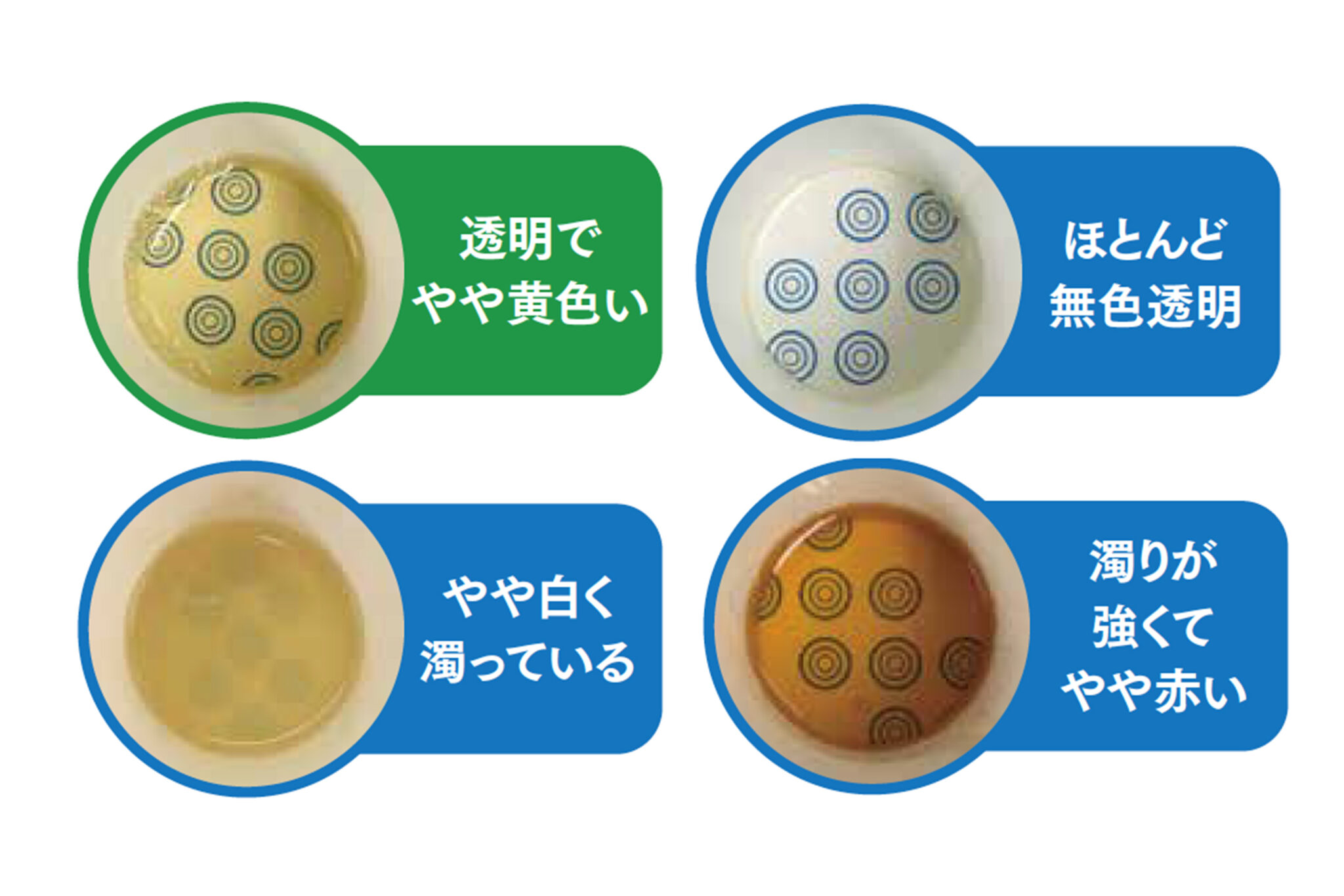 泡状のうんちの原因は何ですか?